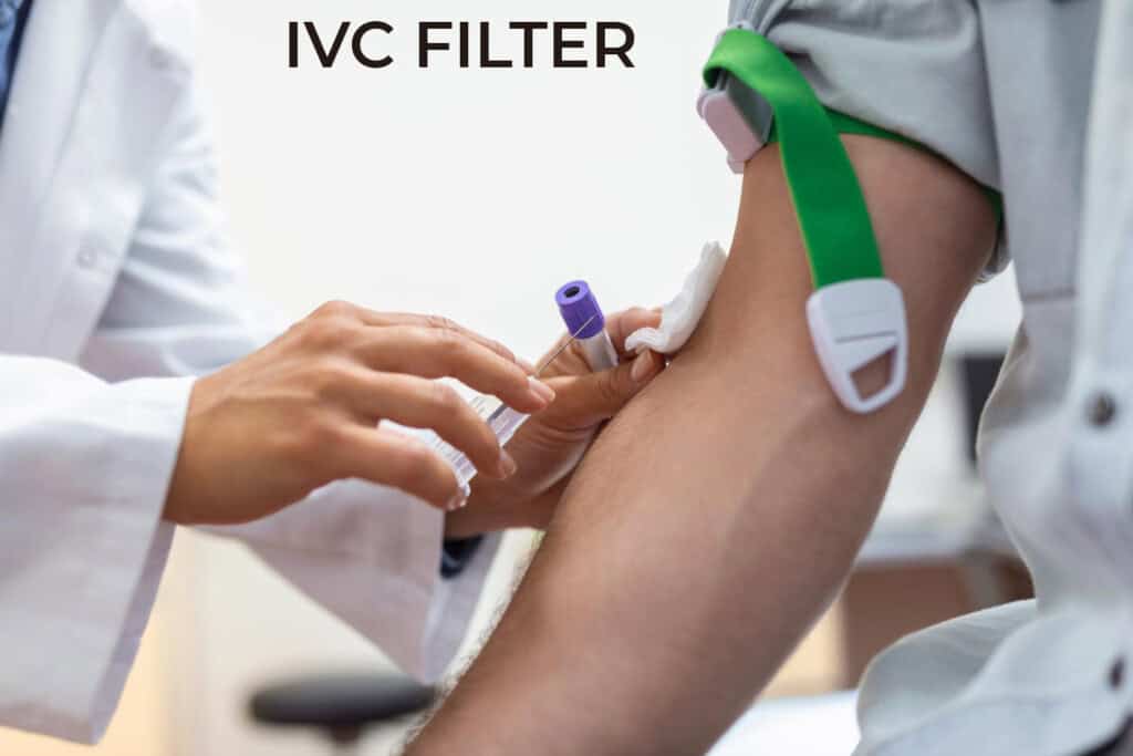 Cook IVC Filter Lawsuit Update 2025